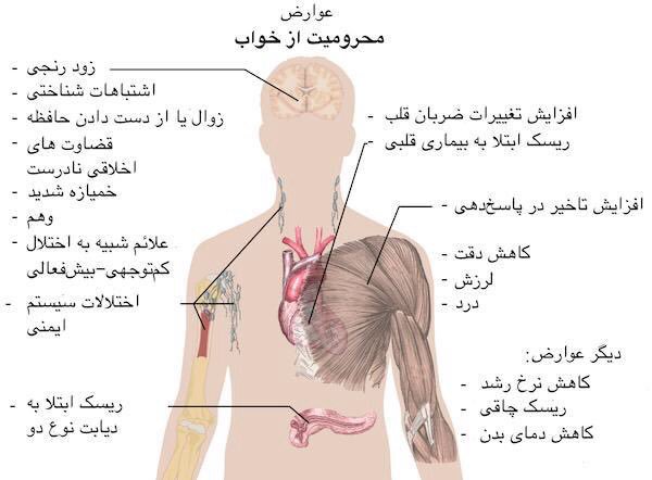 وقتی دیر بخوابیم بدن چه مشکلی پیدا میکند!